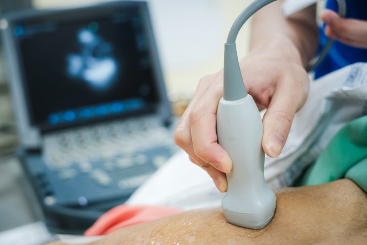 An echocardiogram probe on the chest with the heart image on screen