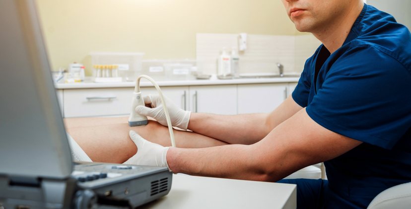 A leg artery ultrasound