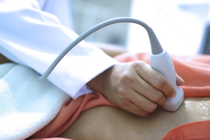 A carotid artery ultrasound of the neck