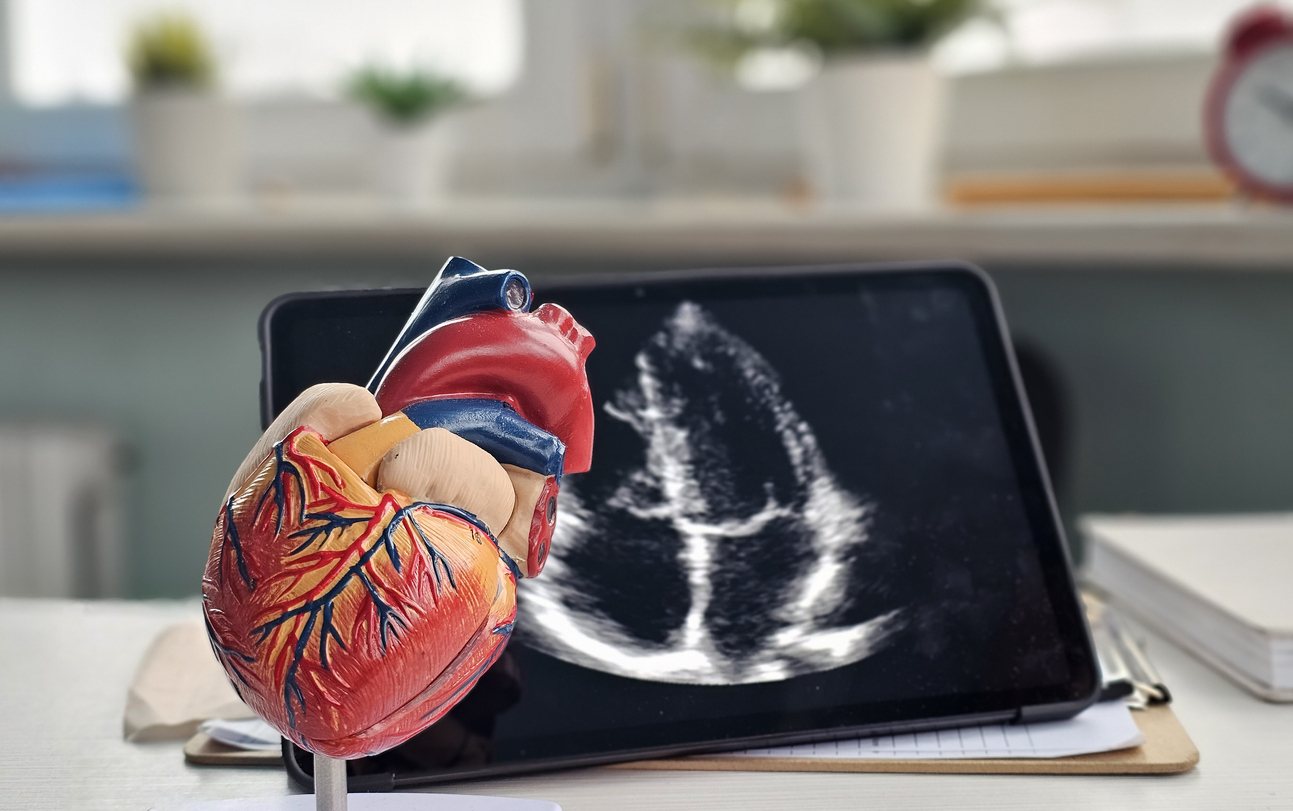 A heart ultrasound in progress