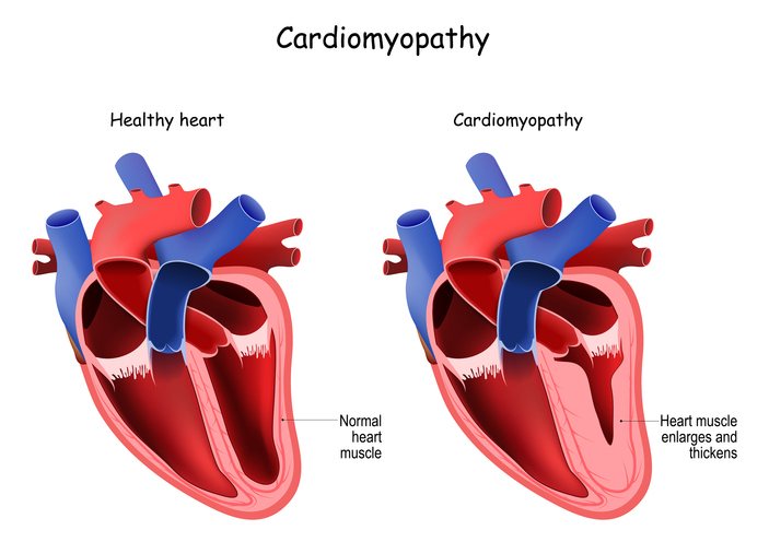 An echocardiogram of the heart on the ultrasound screen