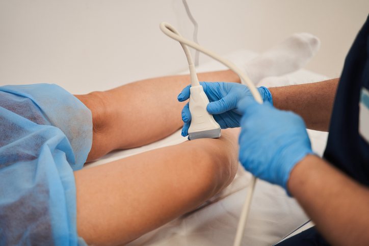 A leg vein ultrasound