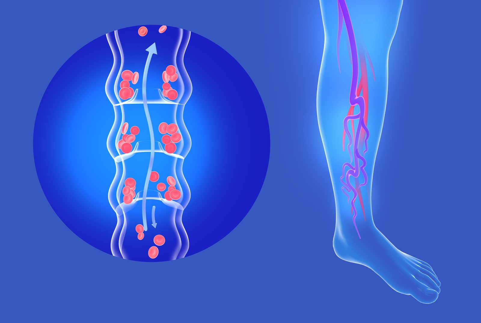A leg vein ultrasound