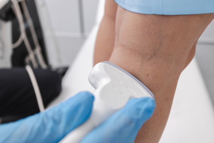 A venous duplex ultrasound of the lower leg